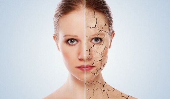 vor und nach Hautverjüngung