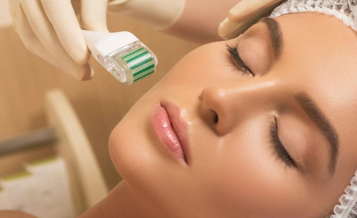 Mesotherapie